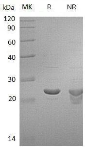 Human GSTP1/FAEES3/GST3 recombinant protein