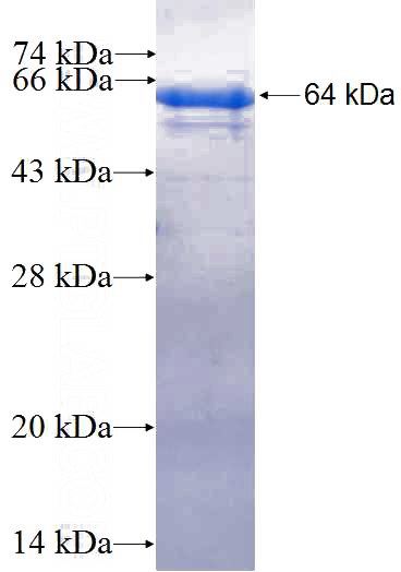 Recombinant Human NFKBIE SDS-PAGE