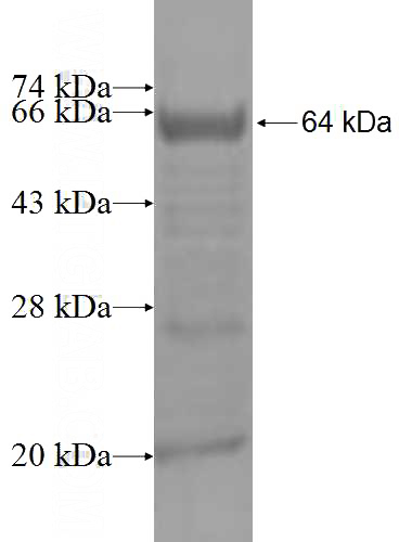Recombinant Human ABCG1 SDS-PAGE