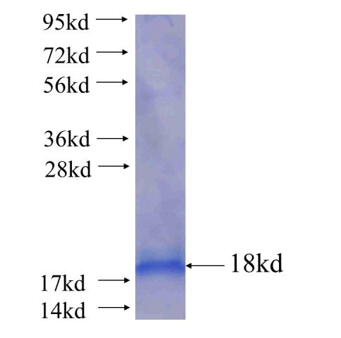 Recombinant human CHCHD7(Full length) SDS-PAGE