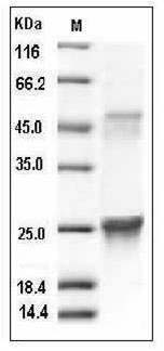 Mouse GLO1 / Glyoxalase 1 Protein (His Tag) SDS-PAGE