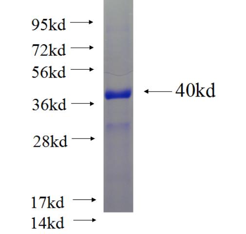 Recombinant human NELL1 SDS-PAGE