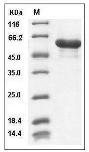 Mouse HSPD1 / HSP60 Protein (His Tag) SDS-PAGE