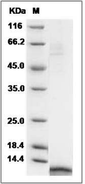 Cynomolgus CCL17 / TARC Protein (His Tag) SDS-PAGE