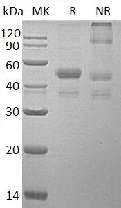 Human ERP44/KIAA0573/TXNDC4 (His tag) recombinant protein