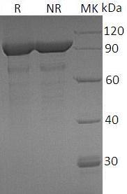 Human KPNB1/NTF97 (His tag) recombinant protein