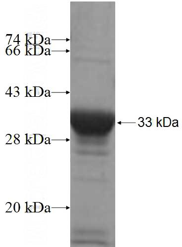 Recombinant Human RAB11FIP5 SDS-PAGE