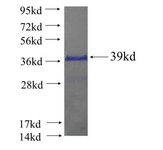 Recombinant human EIF1 SDS-PAGE