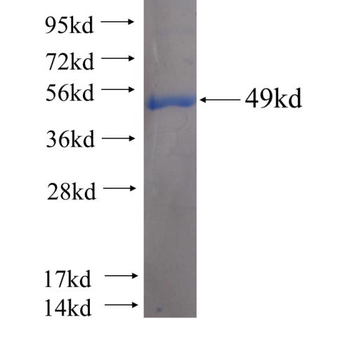 Recombinant human PSMD13(Full length) SDS-PAGE