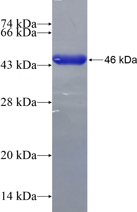 Recombinant Human TH1L SDS-PAGE