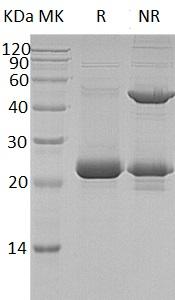 Human ASF1A/CGI-98/HSPC146 (His tag) recombinant protein