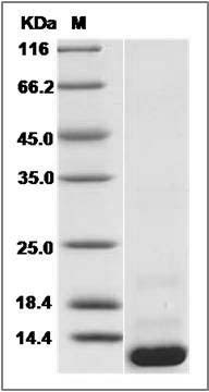 Human CCL20 / MIP-3 alpha Protein (His Tag) SDS-PAGE