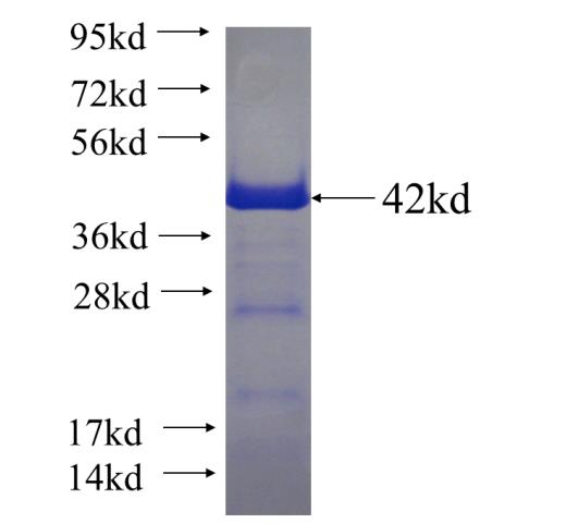 Recombinant human CEP110 SDS-PAGE