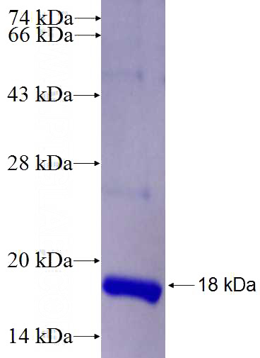 Recombinant Human PPIL5 SDS-PAGE