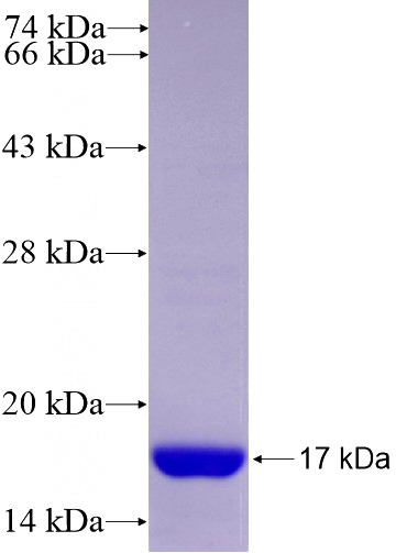 Recombinant Human P2RY1 SDS-PAGE