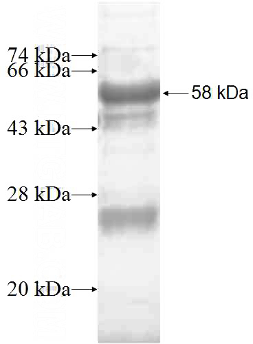 Recombinant Human CGRRF1 SDS-PAGE