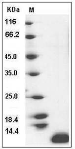 Human CCL17 / TARC / SCYA17 Protein SDS-PAGE