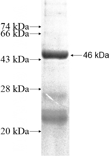 Recombinant Human C11orf79 SDS-PAGE