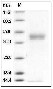 Human Pancreasin / Marapsin / PRSS27 Protein (His Tag) SDS-PAGE