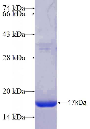 Recombinant Human CCDC109A SDS-PAGE