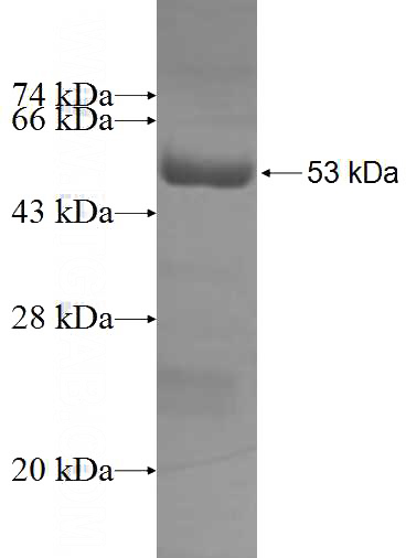 Recombinant Human TNNT1 SDS-PAGE