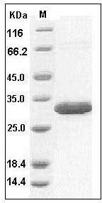 Human Latexin / LXN / TCI Protein (His Tag) SDS-PAGE