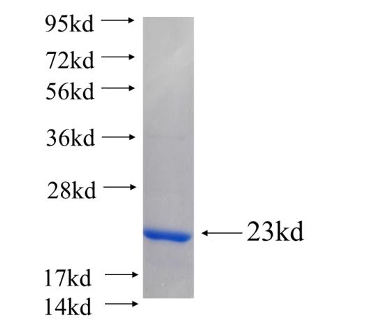 Recombinant human FAM107A(Full length) SDS-PAGE
