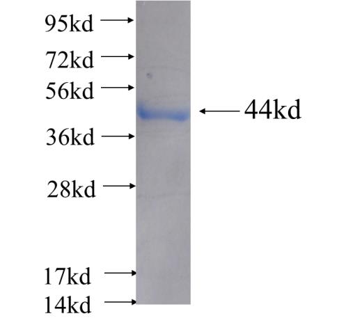 Recombinant human CYP27A1 SDS-PAGE
