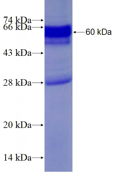 Recombinant Human LDLRAP1 SDS-PAGE