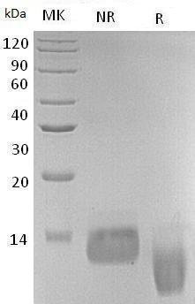 Human CCL17/SCYA17/TARC (His tag) recombinant protein