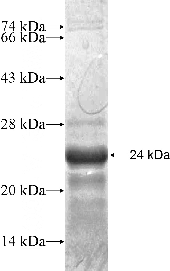 Recombinant Human LHX5 SDS-PAGE