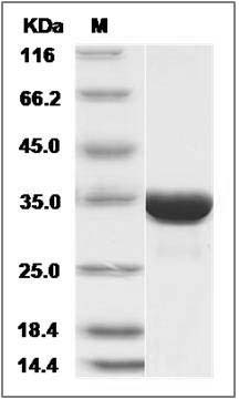 Human MAPRE3 / EB3 Protein (His Tag) SDS-PAGE