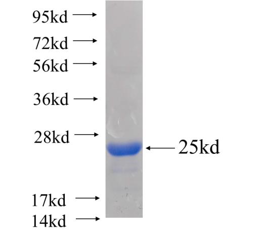 Recombinant human BCL2L10 SDS-PAGE