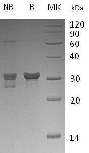 Human PAFAH1B2/PAFAHB (His tag) recombinant protein