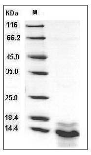 Human S100A14 / S114 Protein (His Tag) SDS-PAGE