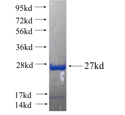 Recombinant human DHFR SDS-PAGE