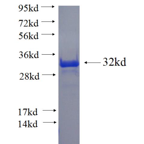 Recombinant human RPS6KB2 SDS-PAGE