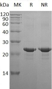 Human NEDD8 (His tag) recombinant protein