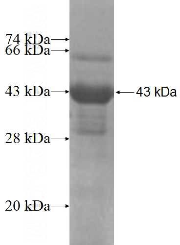 Recombinant Human AFF4 SDS-PAGE