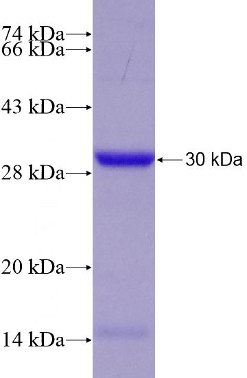 Recombinant Human EML4 SDS-PAGE