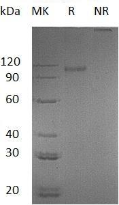 Mouse Flt3/Flk-2/Flt-3 (His tag) recombinant protein