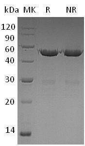 Human UBE2S/E2EPF/OK/SW-cl.73 (GST tag) recombinant protein