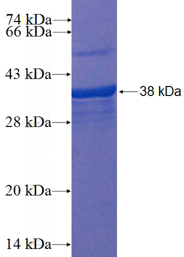Recombinant Human OLIG2 SDS-PAGE