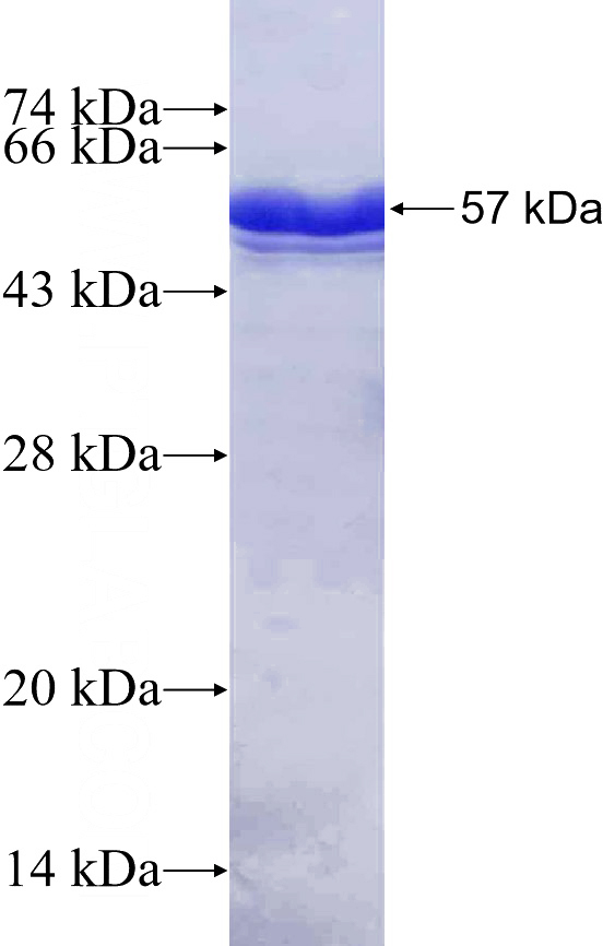 Recombinant Human SP6 SDS-PAGE