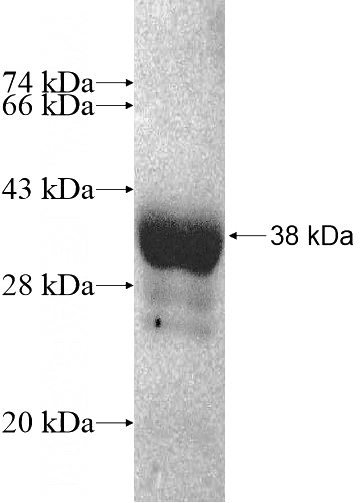 Recombinant Human HOXD4 SDS-PAGE