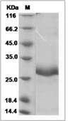 Canine IGFBP1 / IGFBP-1 Protein (His Tag)