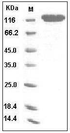 Human CD146 / MCAM Protein (Fc Tag) SDS-PAGE