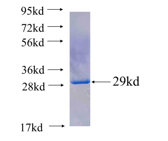 Recombinant human PSMB3(Full length) SDS-PAGE