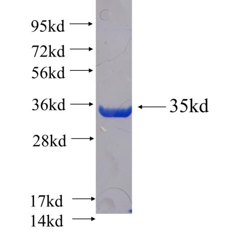 Recombinant human CCDC109A SDS-PAGE