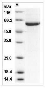 Human STK4 / MST1 Protein (His Tag) SDS-PAGE